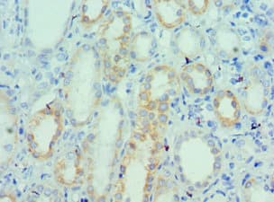 UTS2 / Urotensin II Antibody (aa35-124)