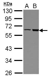 FRMD8 Antibody