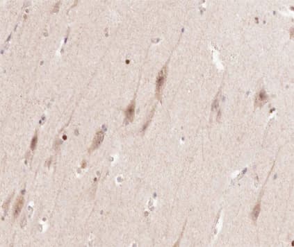 ENO2 / NSE Antibody
