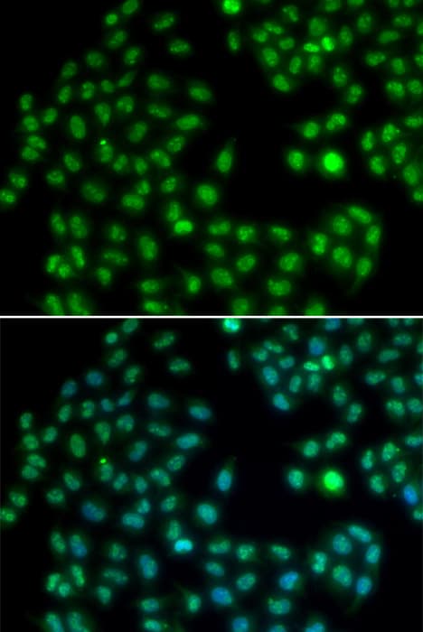 MKI67 / Ki67 Antibody