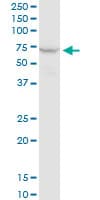 IHC-plus™ Monoclonal Mouse anti-Human PPP2R1A Antibody (clone 4E6, IHC, WB)