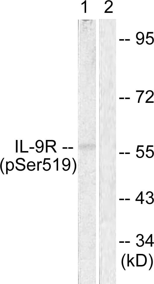 IL9R / CD129 Antibody (phospho-Ser519)