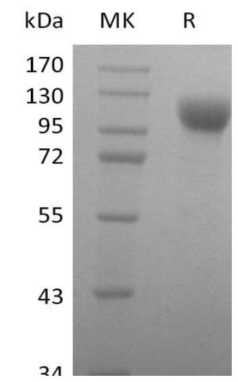 Human ACE2 / ACE-2 Protein (Recombinant AVI-6His, C-terminus)