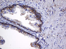 HSPD1 / HSP60 Antibody (clone OTI6F7)