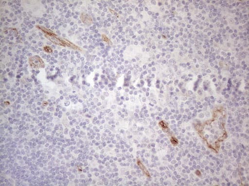 Monoclonal Mouse anti-Human SIP1 Antibody (clone OTI4C11, IHC, WB)