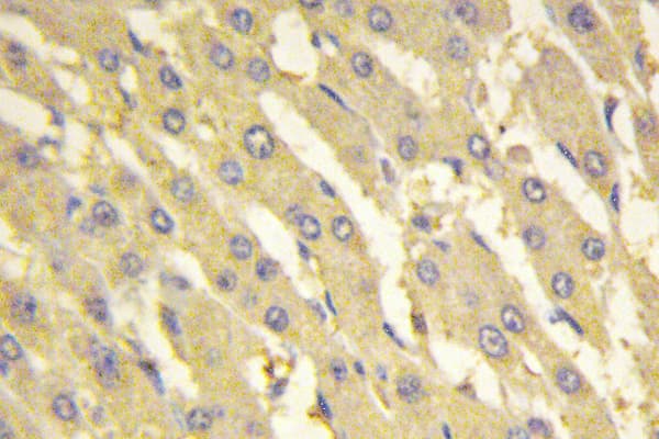 Polyclonal Rabbit anti-Human PFKFB1 Antibody (Glu442, IHC, WB)