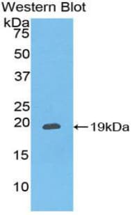 CXCL16 Antibody (aa33-171)