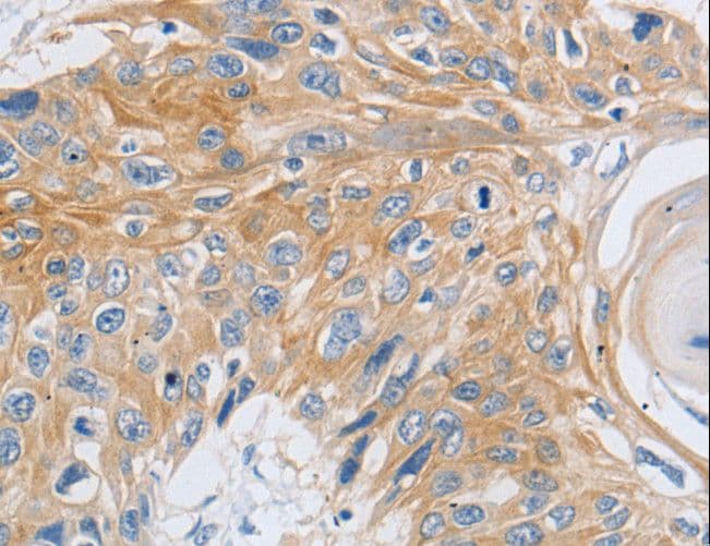 SLC16A7 / MCT2 Antibody