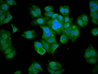 Polyclonal Rabbit anti-Human MBNL3 Antibody (IHC, IF)