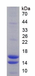 Rat VIP Protein (Recombinant His)