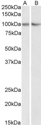 IHC-plus™ LIN41 / TRIM71 Antibody (aa390-402)