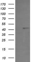 PHF7 Antibody (aa155-381, clone OTI1A2)