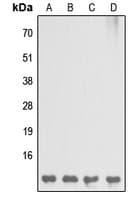 DBI / ACBD1 Antibody (C-Terminus)