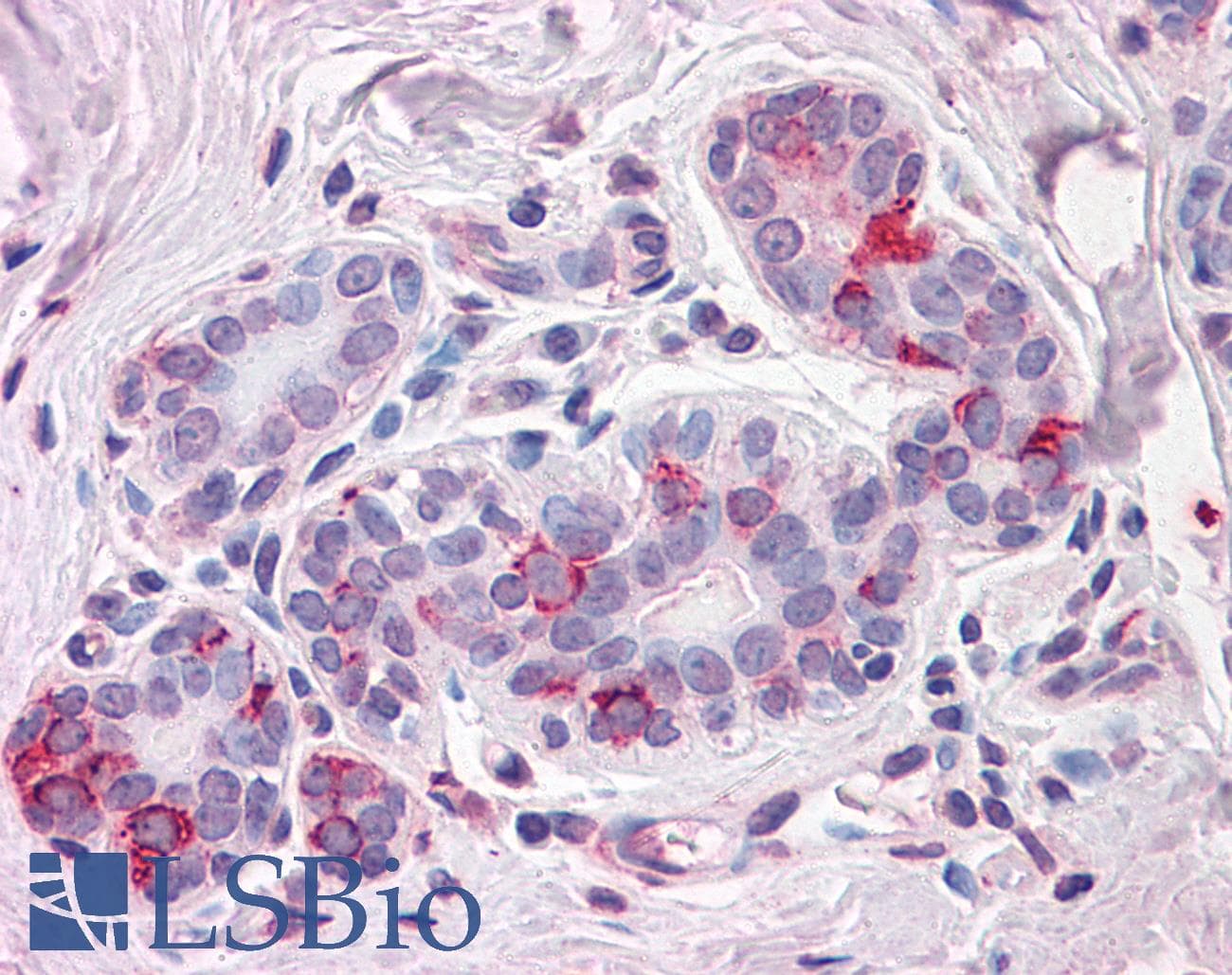 IHC-plus™ Polyclonal Rabbit anti-Human NPTN / SDR1 Antibody (Internal, IHC)