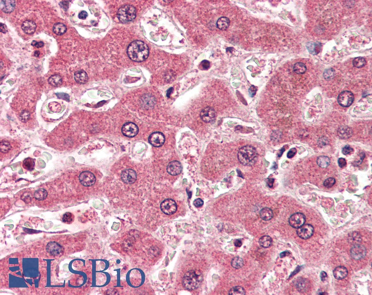 IHC-plus™ APOB / Apolipoprotein B Antibody (aa3984-3995)