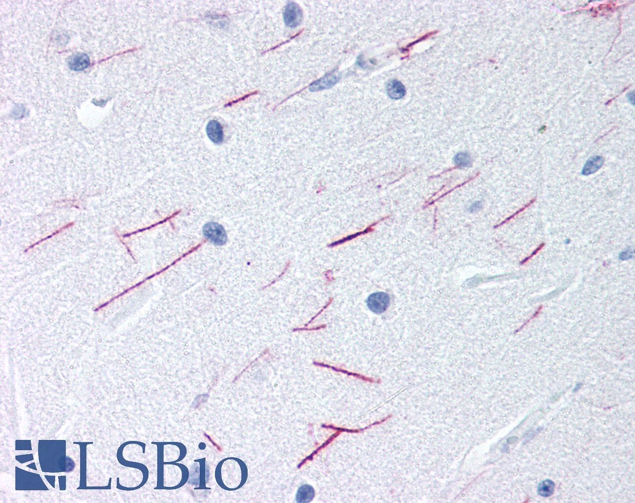 IHC-plus™ Polyclonal Rabbit anti-Human GPR68 / OGR1 Antibody (Cytoplasmic Domain, IHC)