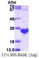 Human Complement C8g Protein (Recombinant His)