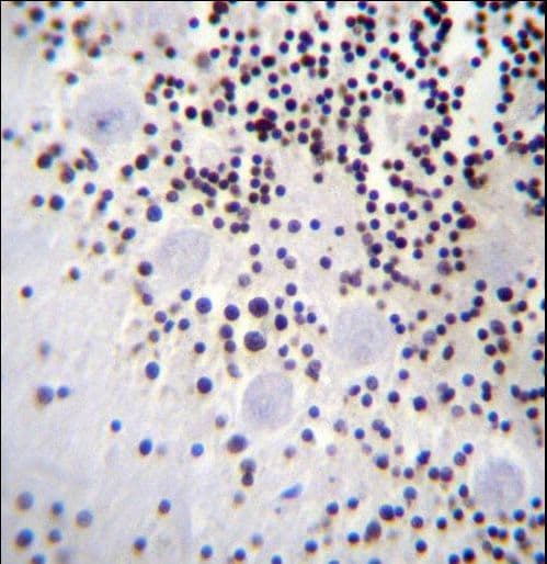 Polyclonal Rabbit anti-Human HIST1H2AB Antibody (aa12-40, IHC, WB)