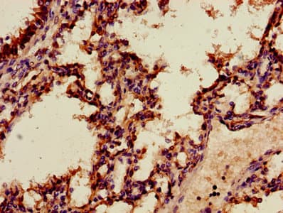 Polyclonal Rabbit anti-Human ANXA2 / Annexin A2 Antibody (aa2-339, IHC, WB)