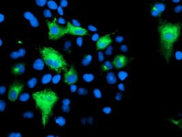 Monoclonal Mouse anti-Human KCNJ3 / GIRK1 Antibody (clone OTI1B1, IF, WB)