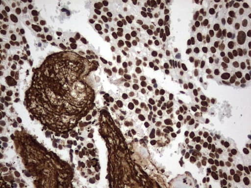 MLF1 Antibody (clone UMAB138)