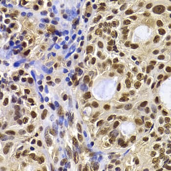 Polyclonal Rabbit anti-Human HIRIP3 Antibody (IHC, IF, WB)