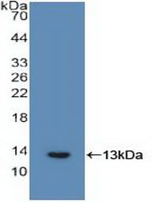 IL6R / IL6 Receptor Antibody (aa216-356, APC)