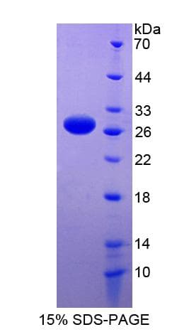 Human RBM38 Protein (Recombinant His-S)