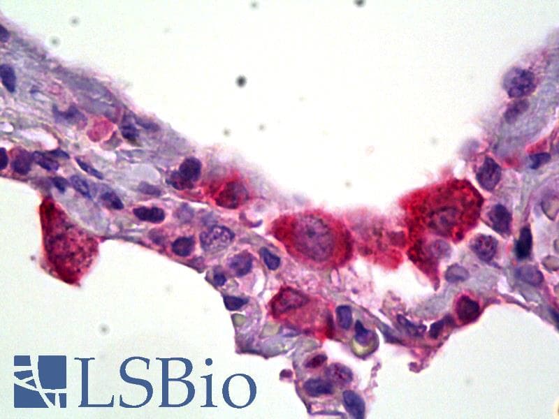 IHC-plus™ HSD11B1 / HSD11B Antibody