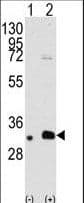 MAGEB2 Antibody (aa4-33)