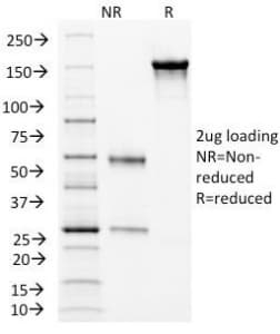 CD105 Antibody (clone ENG/1326)