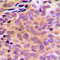 AKR1E2 Antibody (Internal)