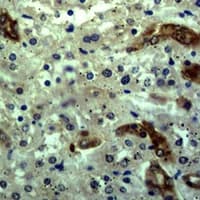 Polyclonal Rabbit anti-Human KRT18 / CK18 / Cytokeratin 18 Antibody (IHC, WB)