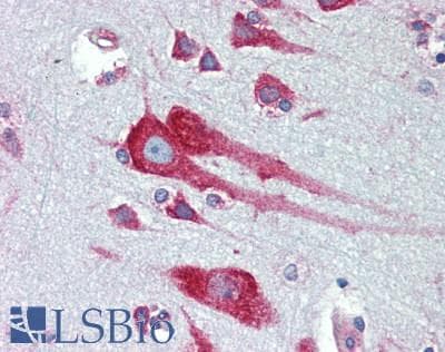 IHC-plus™ PA2G4 / EBP1 Antibody (aa300-345)
