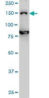 Monoclonal Mouse anti-Human DHX8 Antibody (clone 1E10, WB)