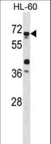 Polyclonal Rabbit anti-Human ATG4D Antibody (aa220-249, IHC, WB)