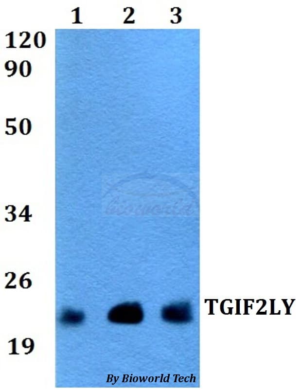 Polyclonal Rabbit anti-Human TGIF2LY Antibody (WB)