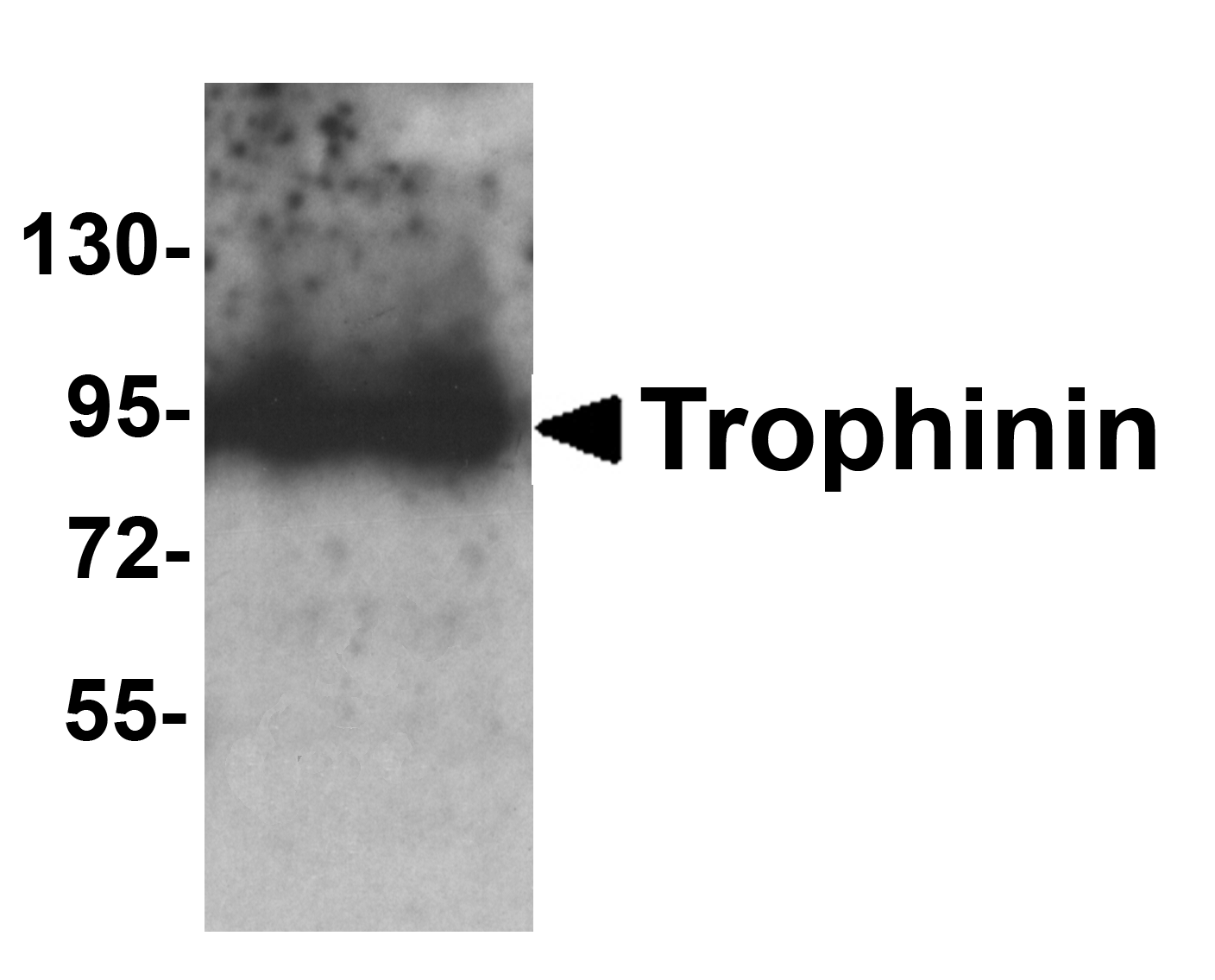 TRO / Trophonin Antibody