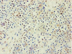 ABCF2 Antibody (aa1-250)