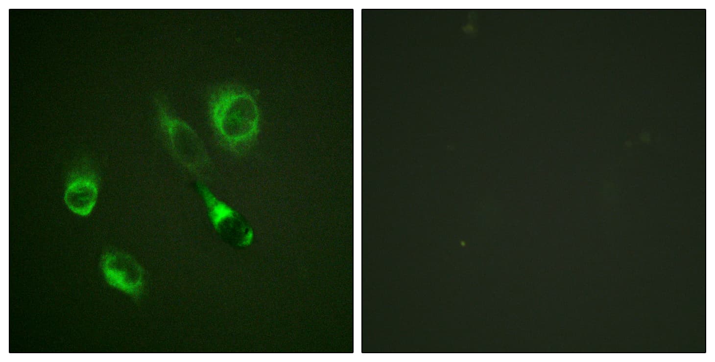 EPH Receptor A2+A3 Antibody (phospho-Tyr588/Tyr596)