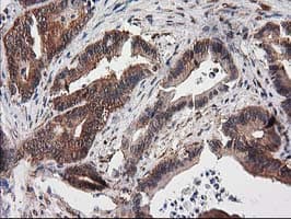 DSTN / Destrin Antibody (clone OTI2F7)