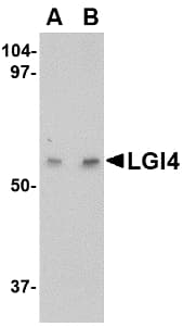 IHC-plus™ LGI4 Antibody