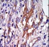 AURKA / Aurora-A Antibody (aa90-120)