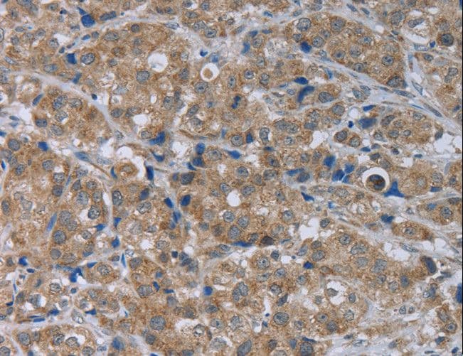 GABRB1 Antibody