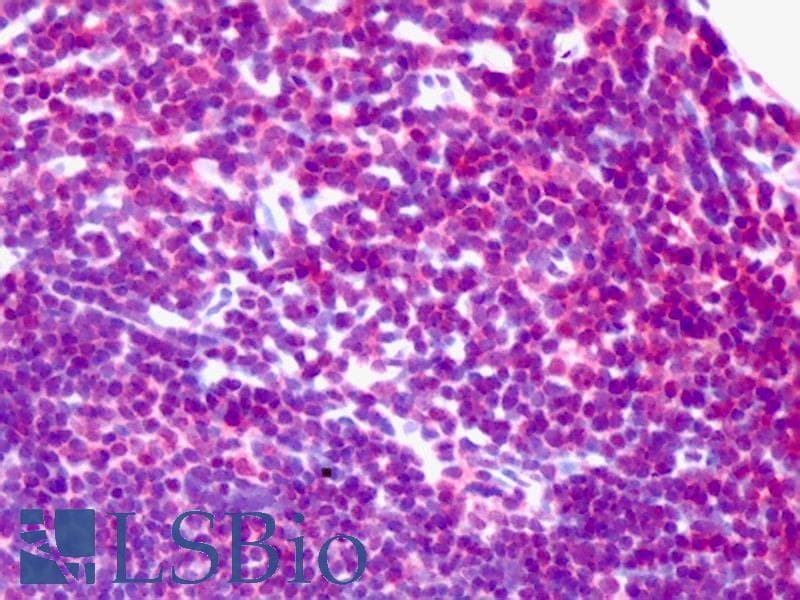 IHC-plus™ Polyclonal Rabbit anti-Human NEK2 Antibody (IHC, IF, WB)