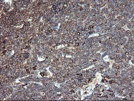 CLEC4E / MINCLE Antibody (clone OTI2A8, Carrier-free)