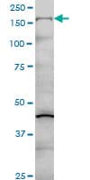 COL5A1 / Collagen V Alpha 1 Antibody (clone 2F4)