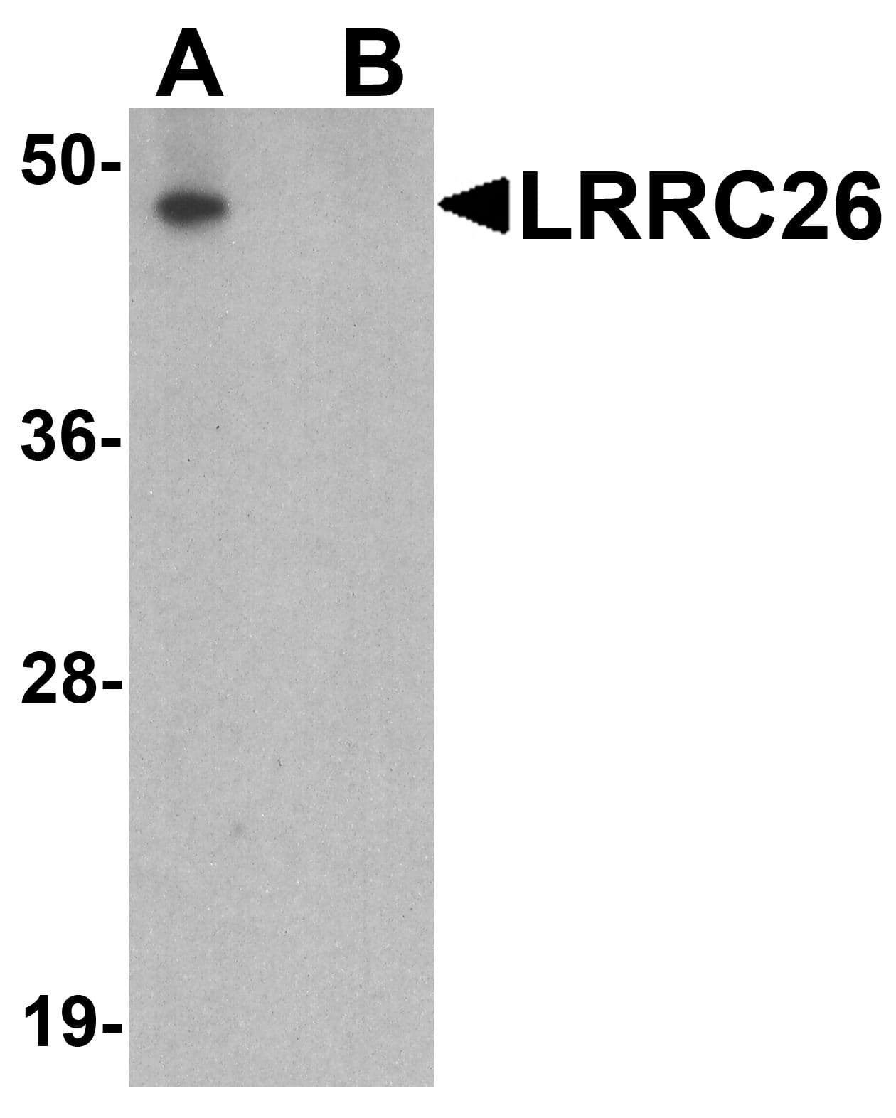 Polyclonal Rabbit anti-Human LRRC26 Antibody (IHC, IF, WB)