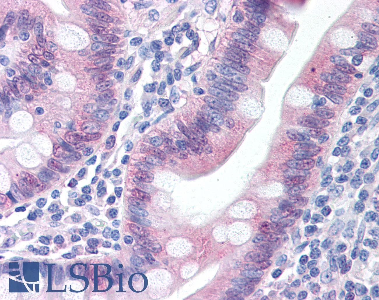 IHC-plus™ CASP1 / Caspase 1 Antibody (aa371-390, clone 14F468)