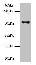 PNPLA3 / Adiponutrin Antibody (aa377-481)